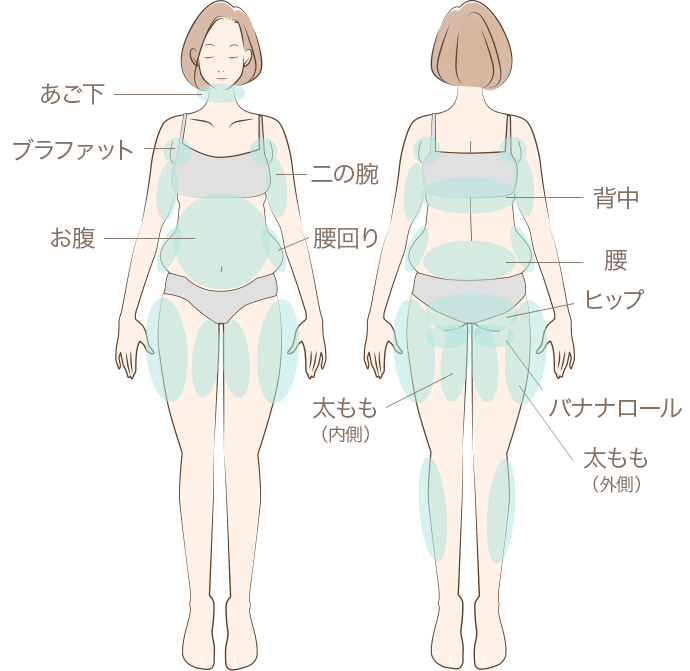 クールスカルプティング®の対象部位
