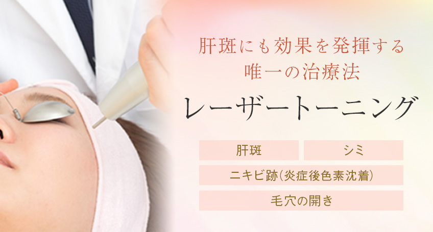 肝斑・シミ そばかすを解消するレーザートーニング