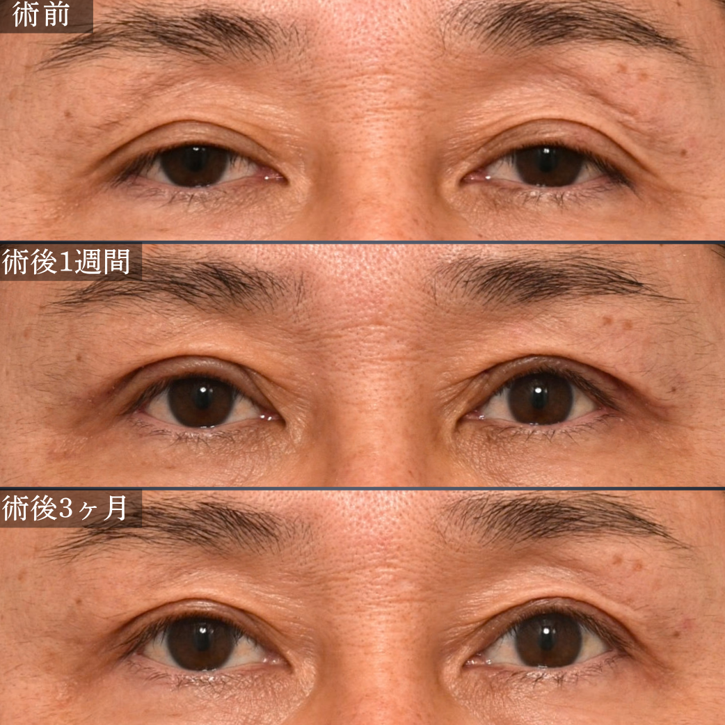 症例1 