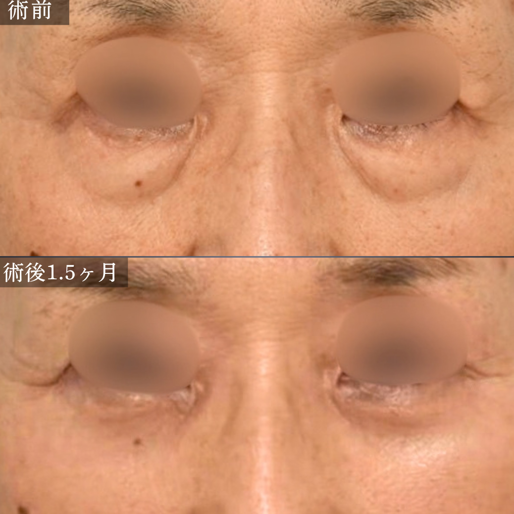 症例2 