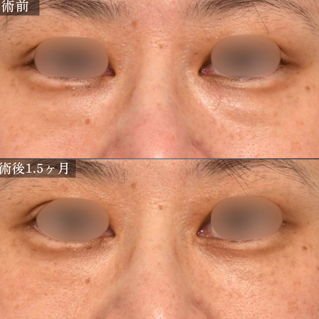症例3 
