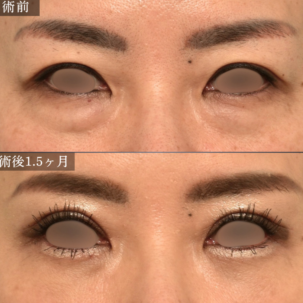 症例5 