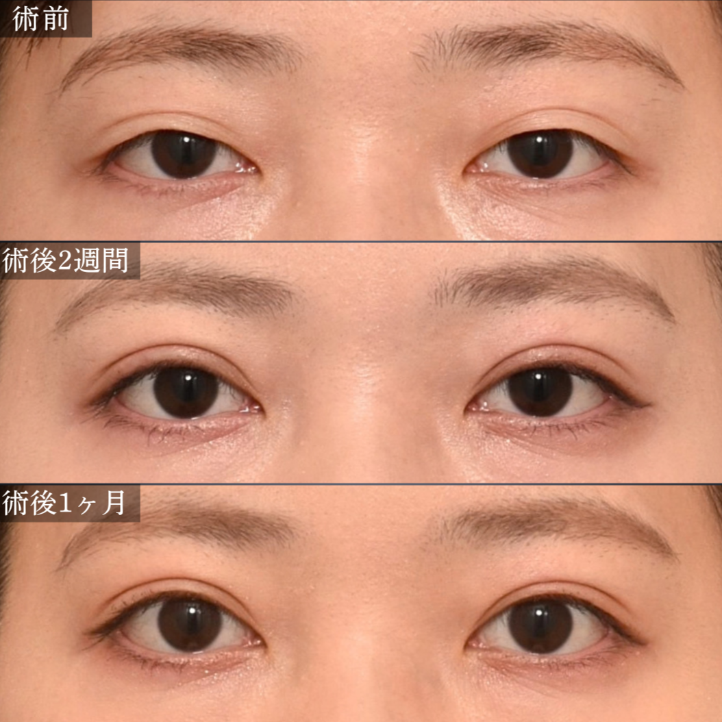 症例5 
