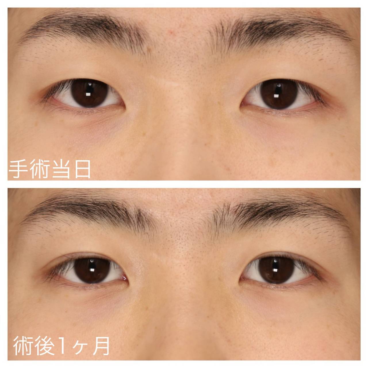 症例8 