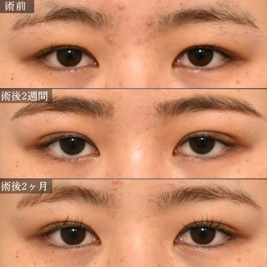 症例4 