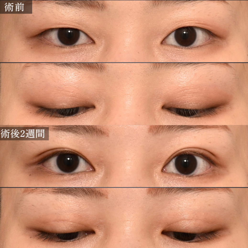 症例1 