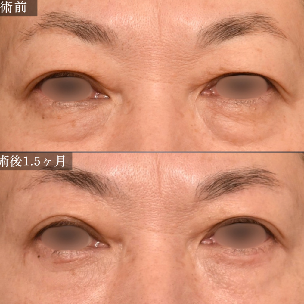 症例8 